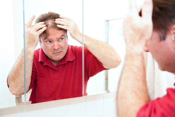 Hói đầu không gây ảnh hưởng trực tiếp đến sức khỏe nhưng nó khiến tâm sinh lý của bạn bị bất ổn