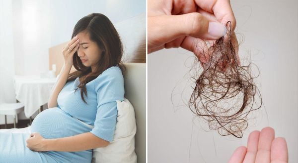 Rụng tóc quá nhiều khi mang thai khiến các bà mẹ thêm lo âu
