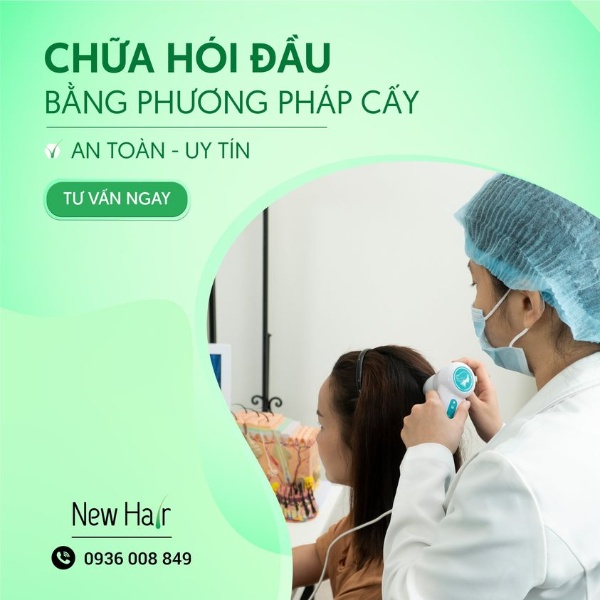 Cấy tóc tự thân tại New Hair đảm bảo an toàn và uy tín