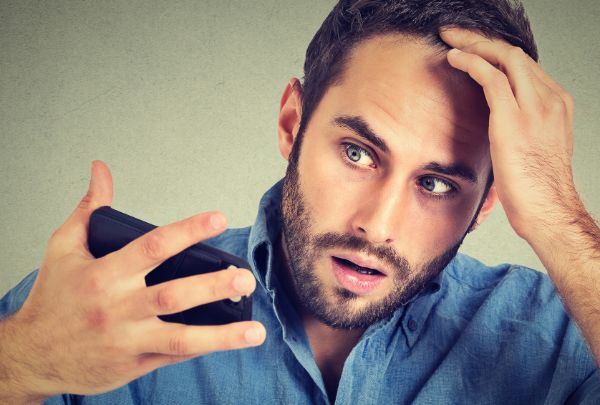 Hói đầu có thể do nhiều nguyên nhân