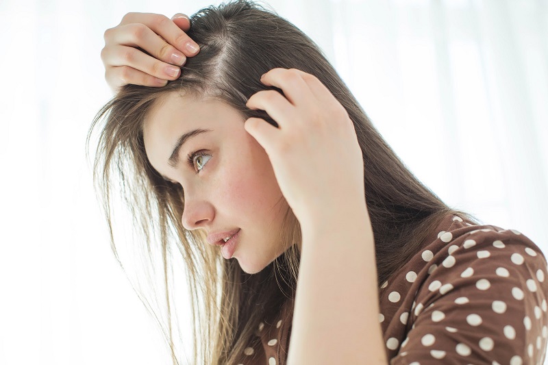 Rối loạn nội tiết tố gây mệt mỏi cũng là nguyên nhân gây hói đầu ở nữ