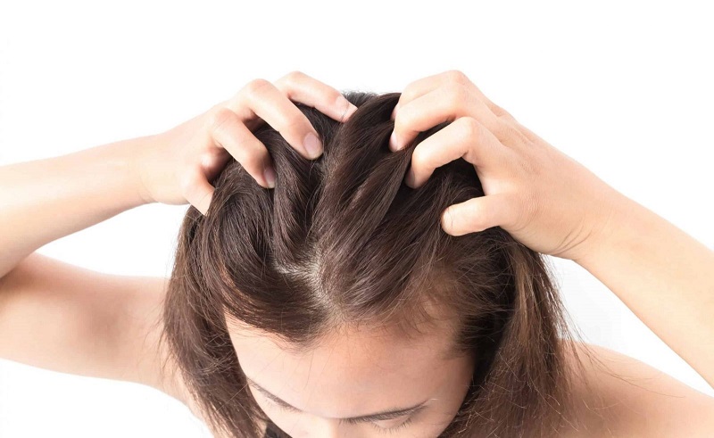 Ngứa da đầu là một trong những biểu hiện của nấm da đầu