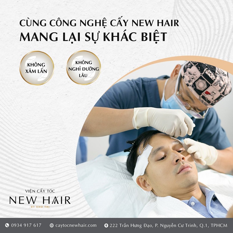 Điều trị hói đầu bằng phương pháp cấy tóc hiệu quả