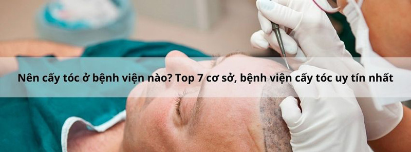 Nên cấy tóc ở bệnh viện nào