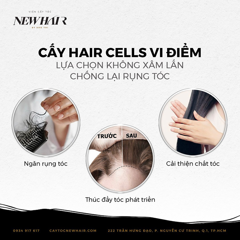 công nghệ cấy Hair Cells vi điểm