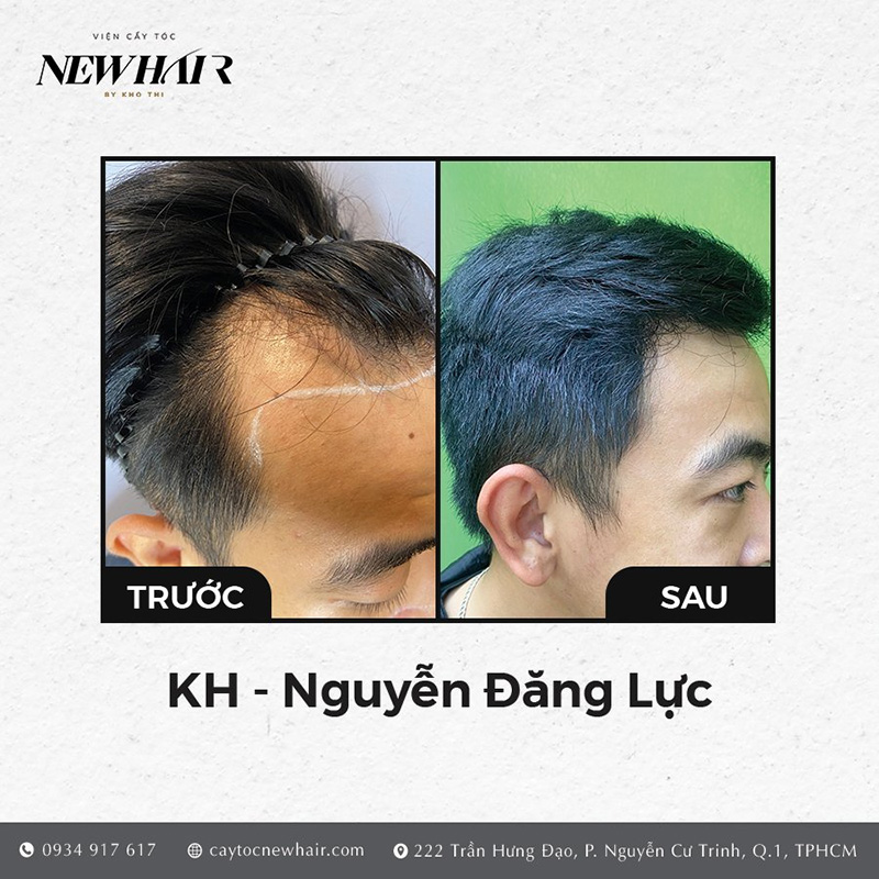 Hình ảnh khách hàng Nguyễn Đăng Lực