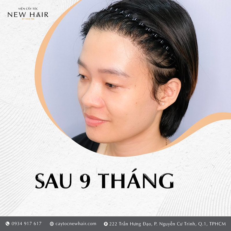 Sau 9 tháng, tóc đã thay đổi rõ rệt