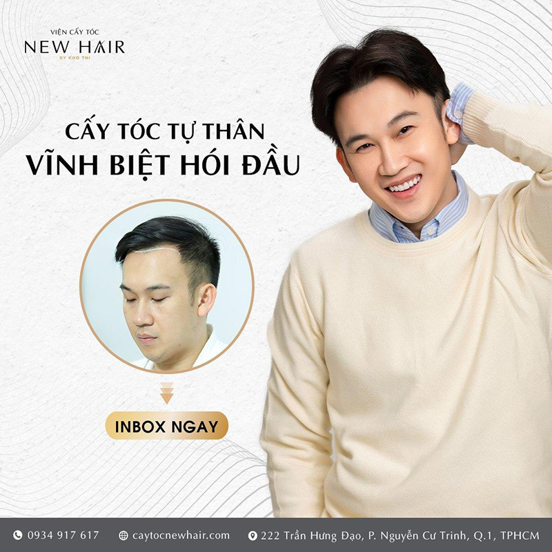 Vĩnh biệt ngay tình trạng hói đầu