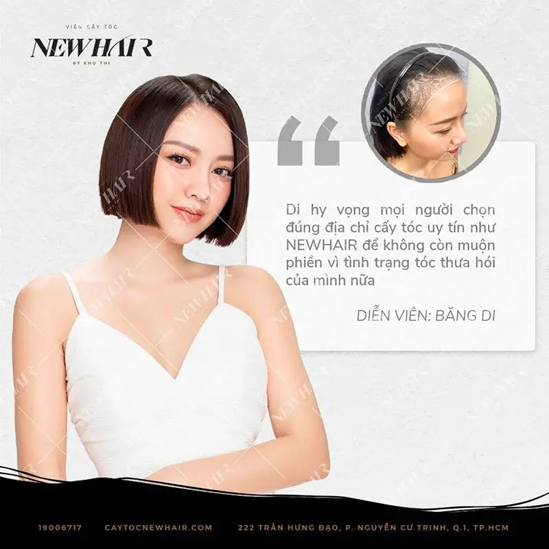 Diễn viên Băng Di review về cấy tóc tự thân new hair