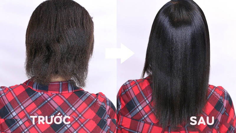 hình ảnh trước và sau khi dùng vitamin B rụng tóc