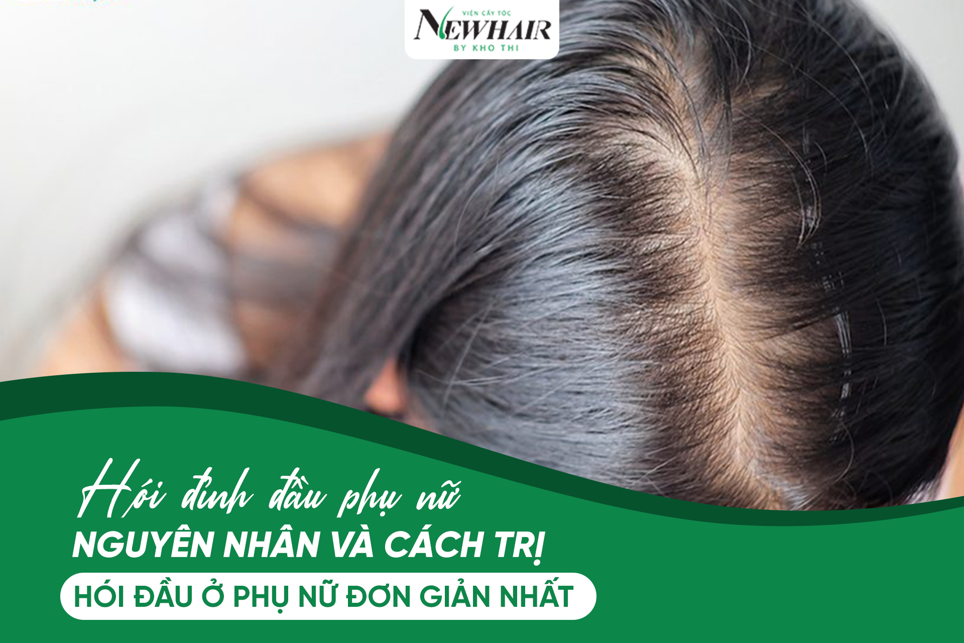 Cách trị hoá đầu ở phụ nữ