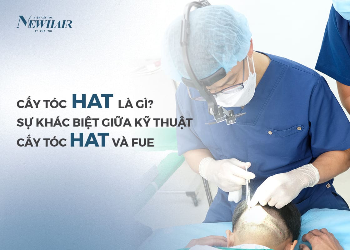 cấy tóc HAT là gì