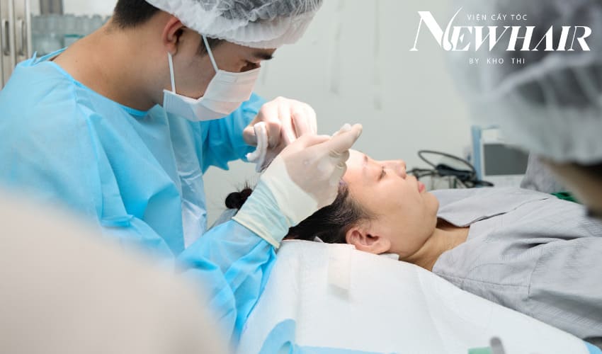 cấy tóc bao lâu thì mọc lại