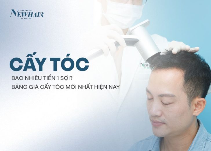 cấy tóc bao nhiêu tiền 1 sợi