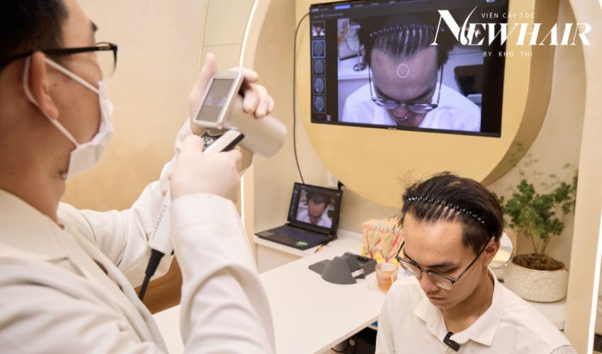 cấy tóc bao nhiêu tiền