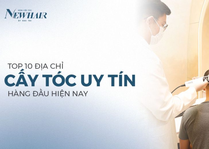 cấy tóc ở đâu uy tín