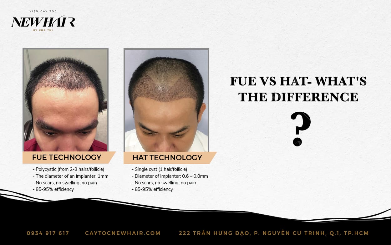 fue vs hat hair transplant