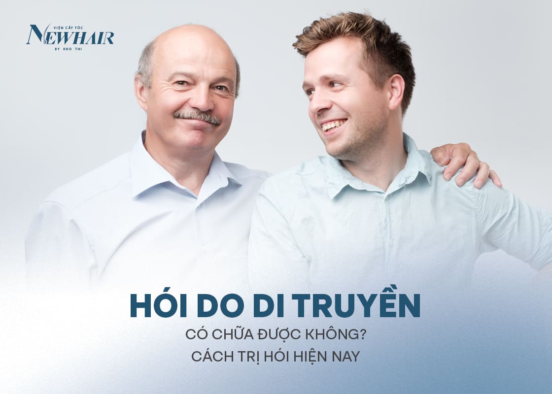 hói do di truyền có chữa được không