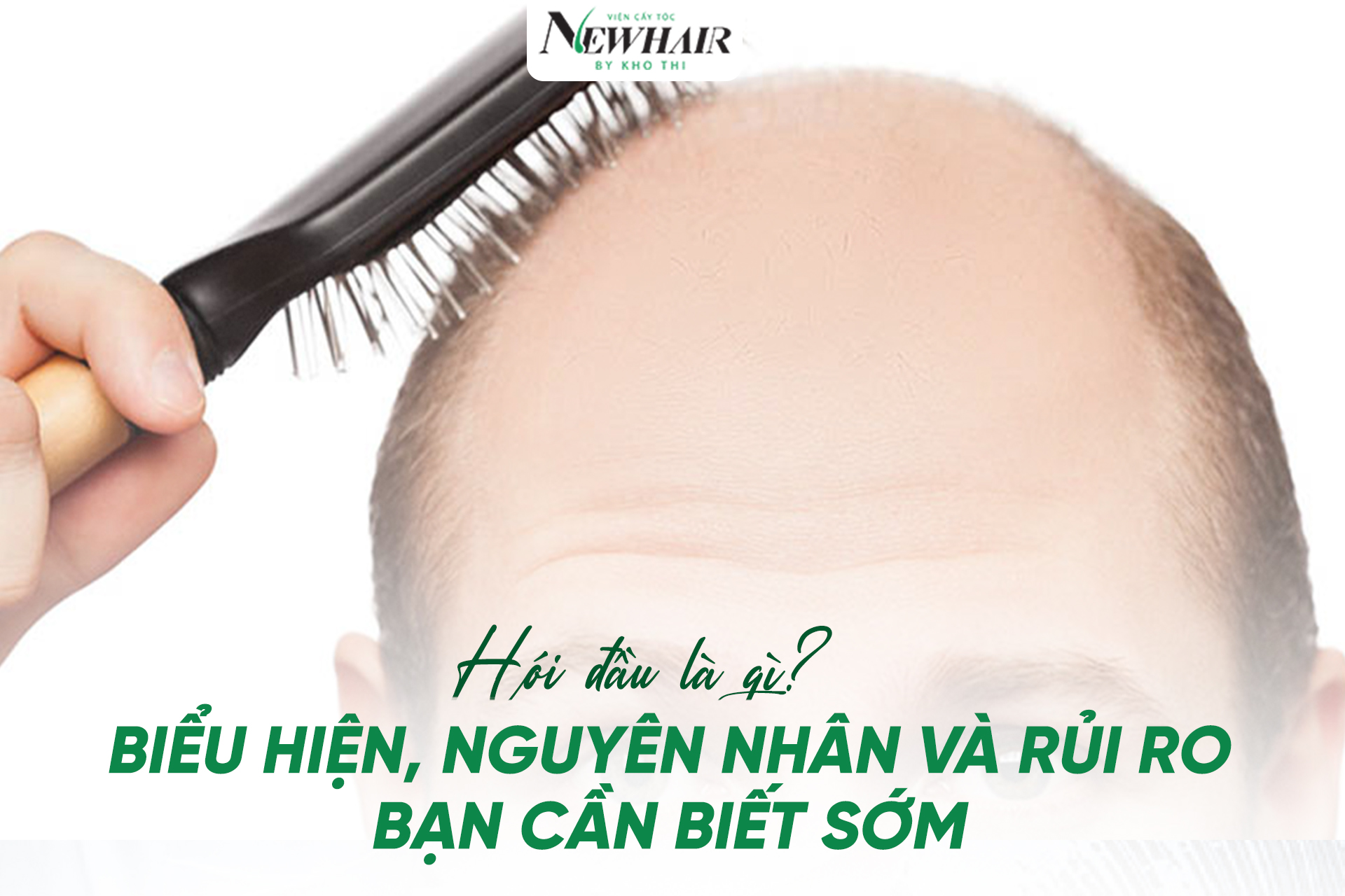hói là gì
