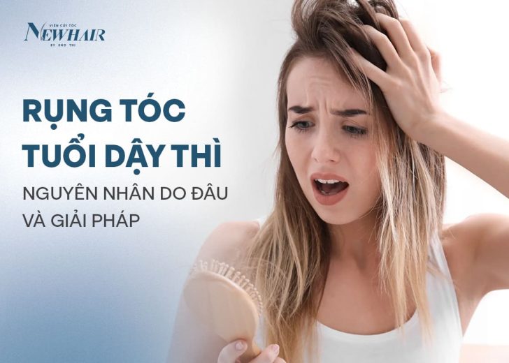 rụng tóc tuổi dậy thì