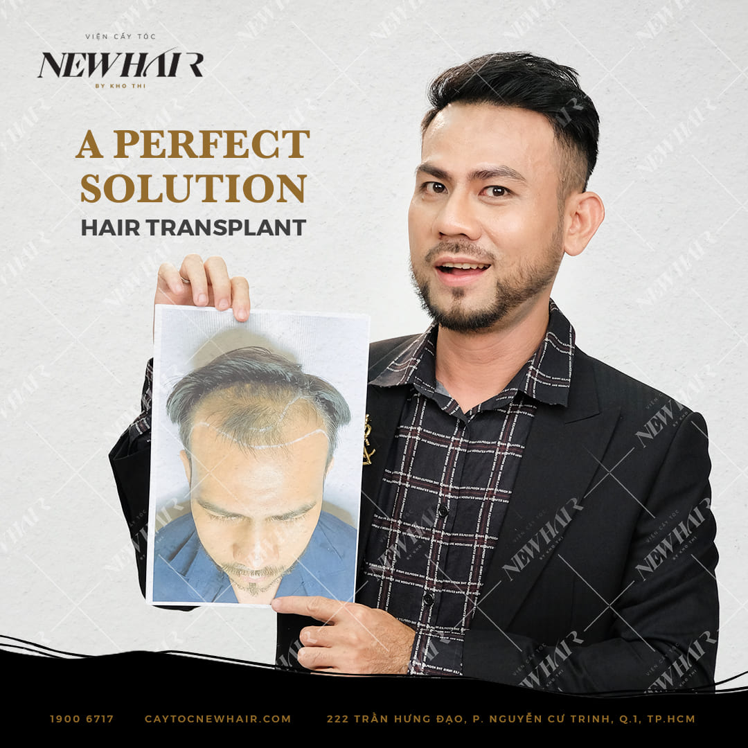 solution for baldness