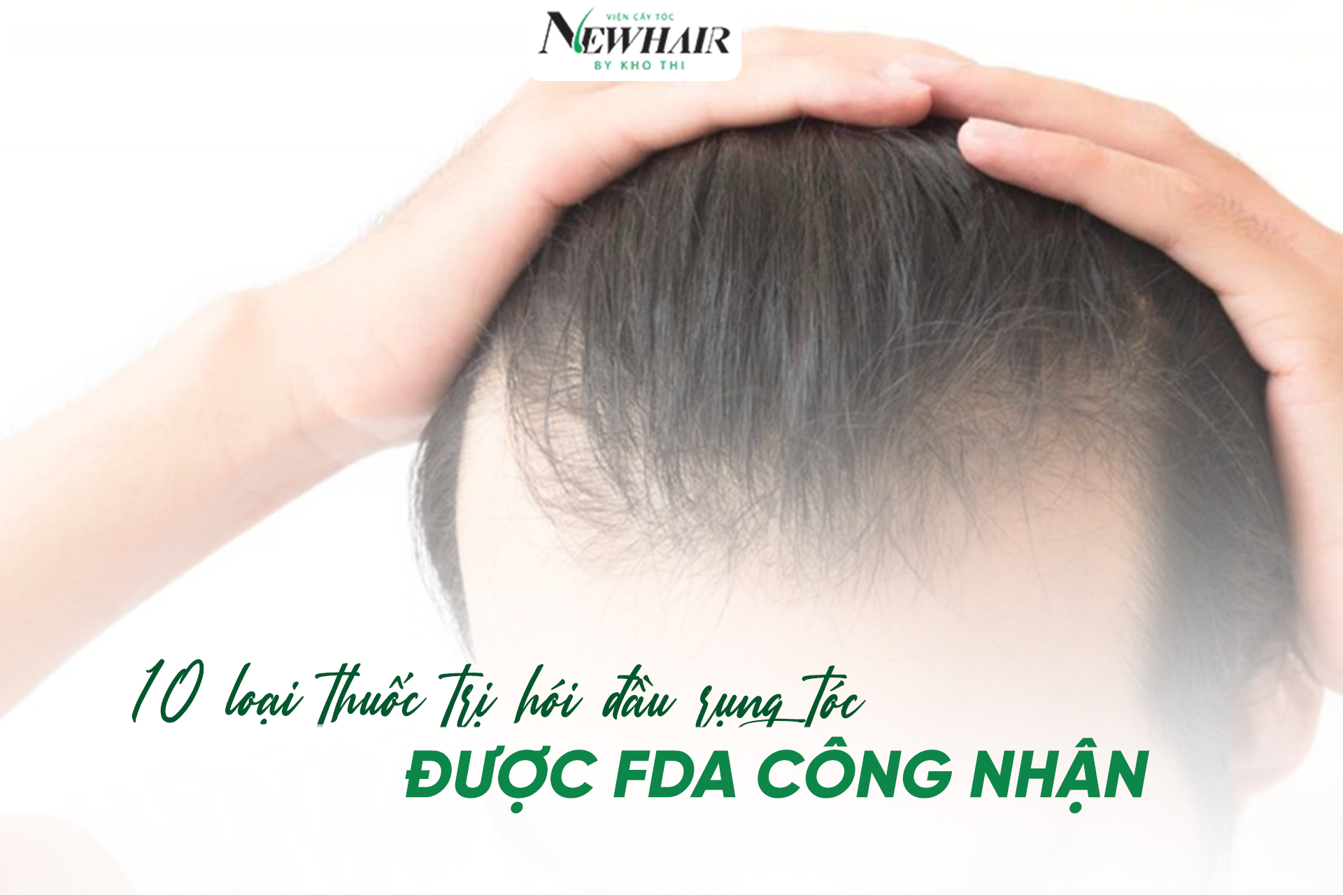 thuốc chữa hói đầu