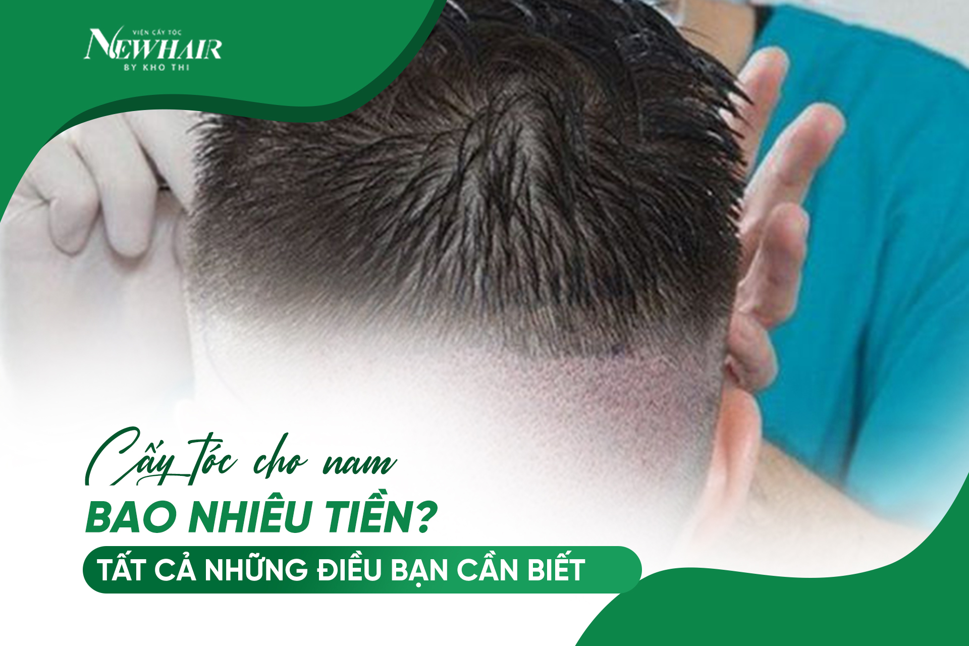 Cay toc nam bao nhieu tien