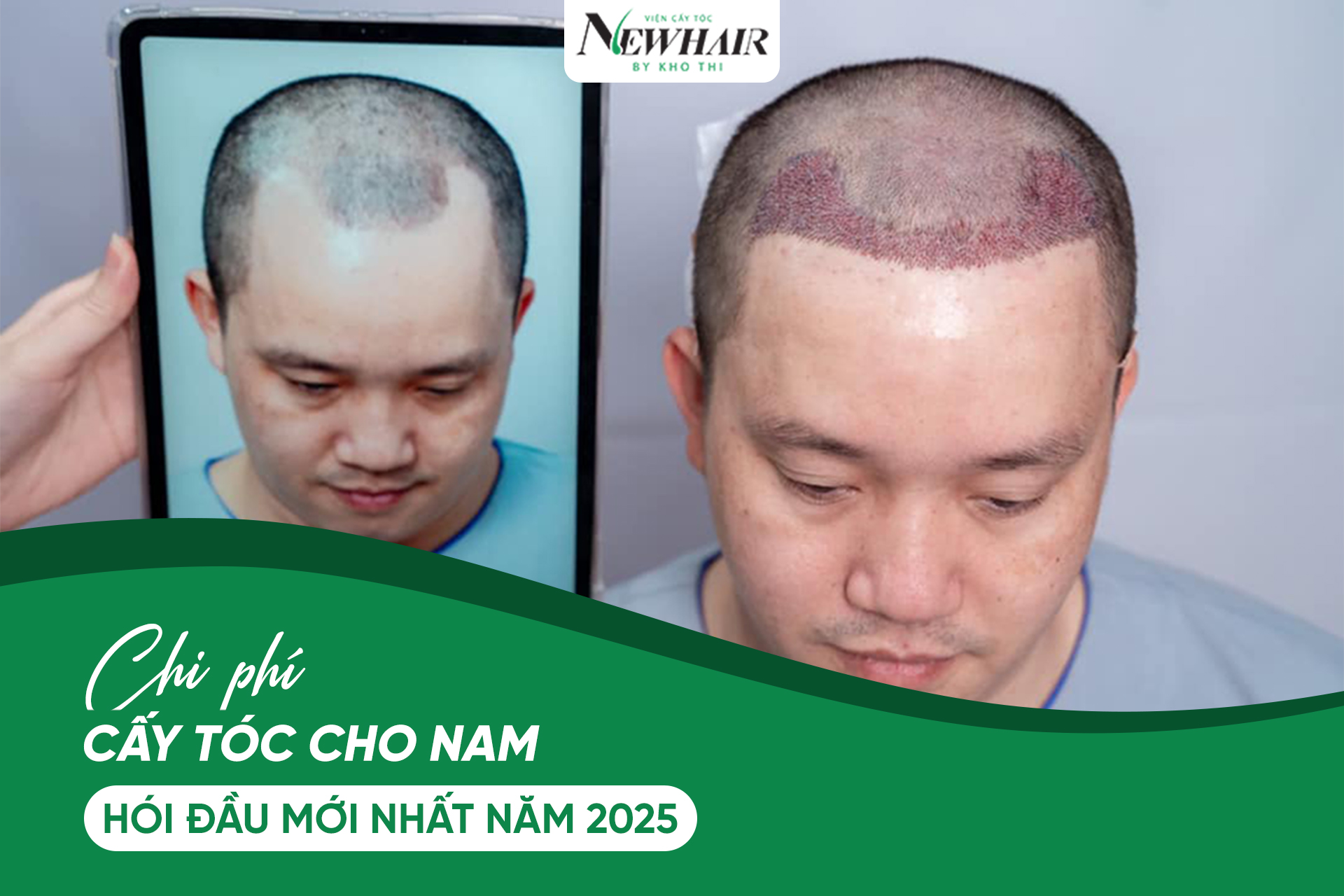 Chi phi cay toc cho nam hoi dau moi nhat nam 2025