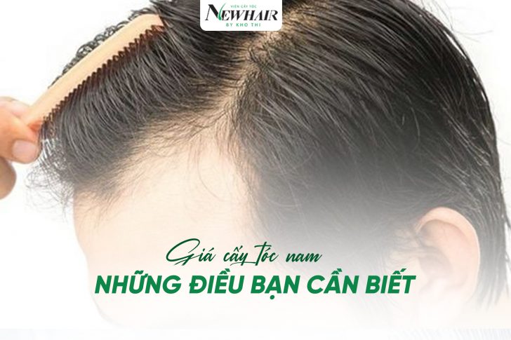 Gia cay toc nam va nhung dieu ban can biet