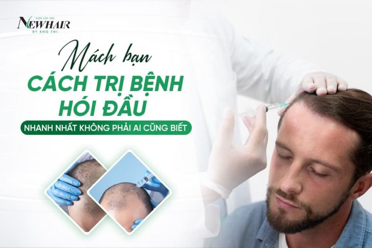 cách trị bệnh hói đầu nhanh nhất