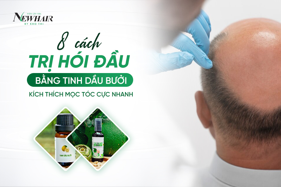 Cách trị hói đầu bằng tinh dầu bưởi