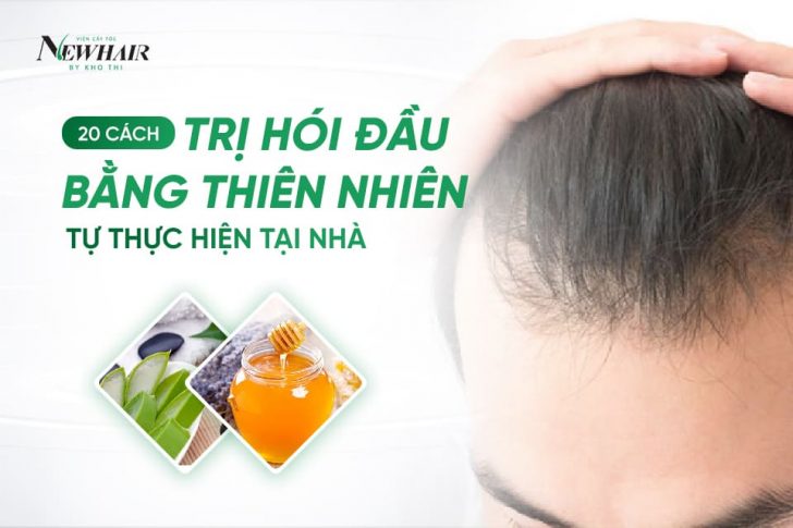 cách trị hói đầu bằng thiên nhiên