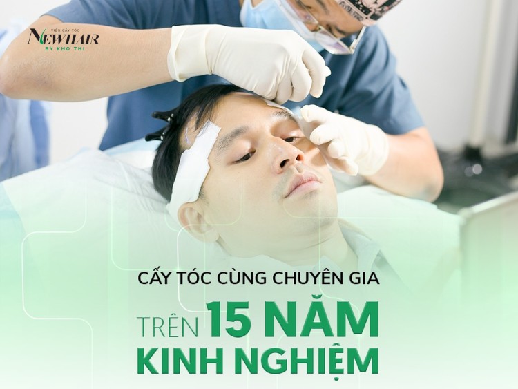 cấy tóc cho nam bao nhiêu tiền