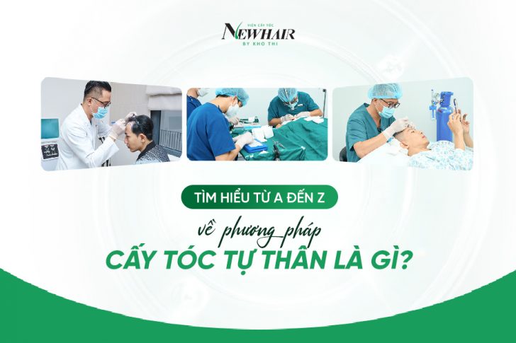 cấy tóc tự thân là gì