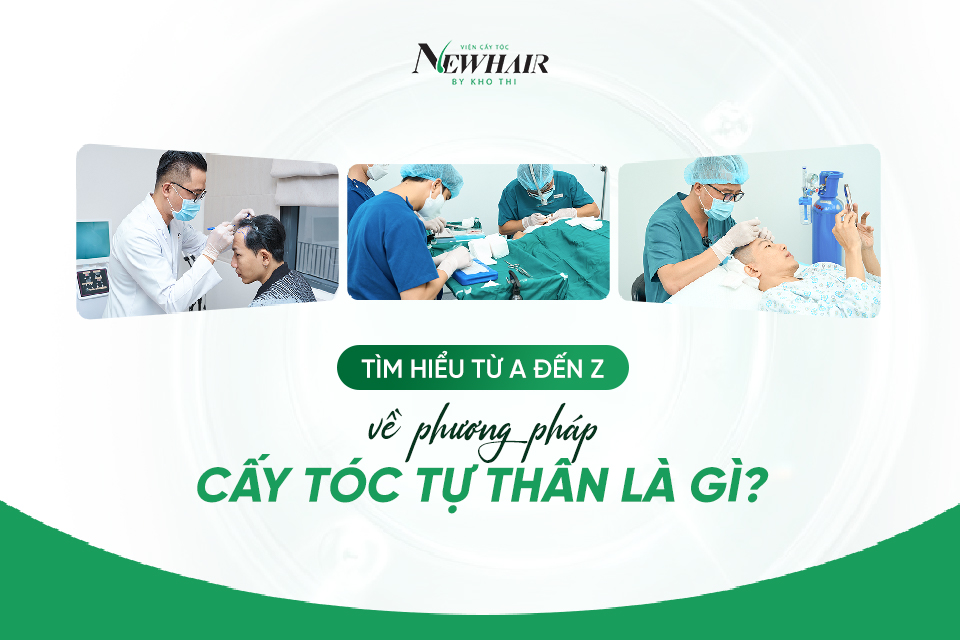 cấy tóc tự thân là gì