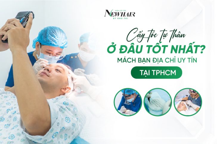 Cấy tóc tự thân ở đâu tốt nhất