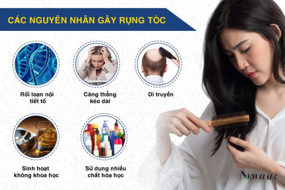 Có nên cấy tóc tự thân