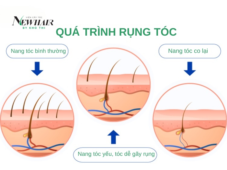 nang tóc là gì