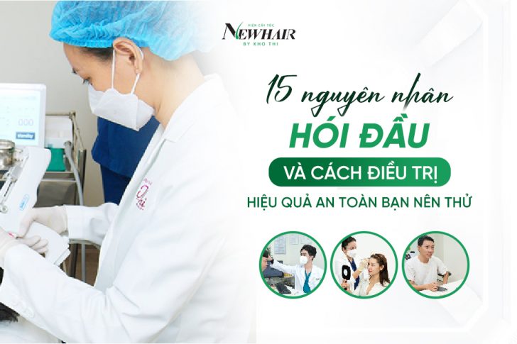 Nguyên nhân hói đầu và cách điề u trị