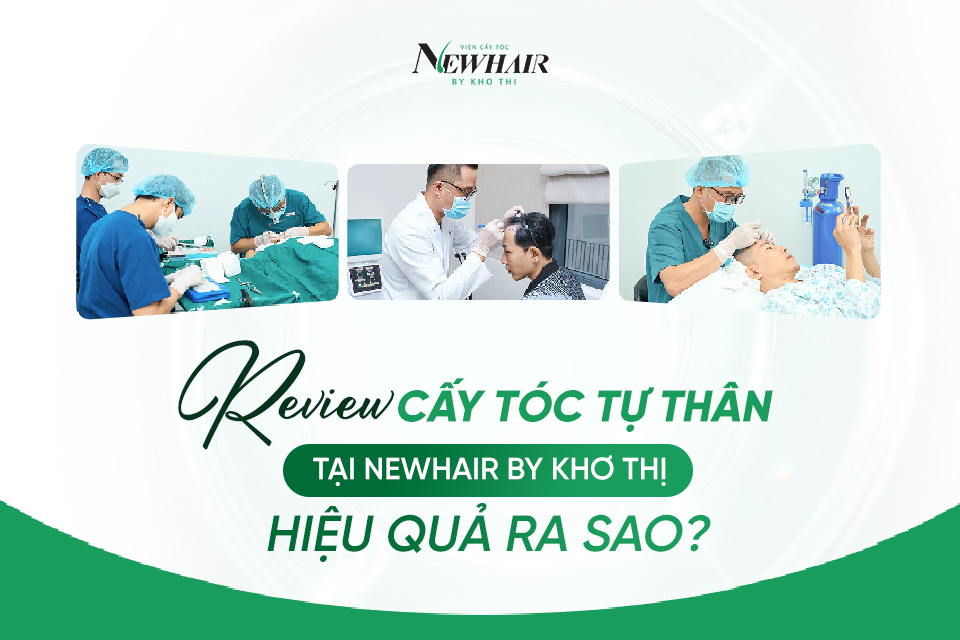 review cấy tóc tự thân