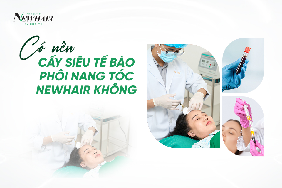 cấy siêu tế bào phôi nang tóc NewHair