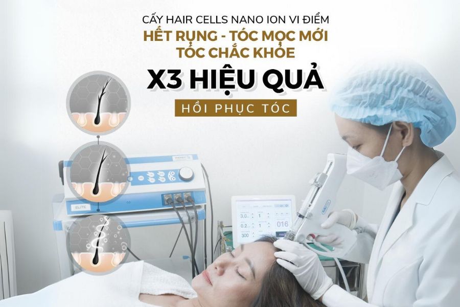 Phục hồi mái tóc bằng phương pháp tiên tiến cấy tóc Hair Cell vi điểm.