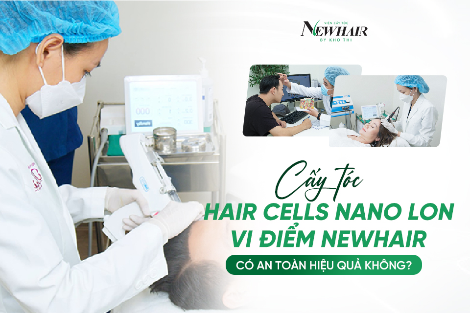 Cấy tóc Hair Cells Nano Ion vi điểm NewHair