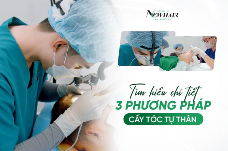 Tìm hiểu chi tiết 3 phương pháp cấy tóc tự thân FUT - FUE - HAT