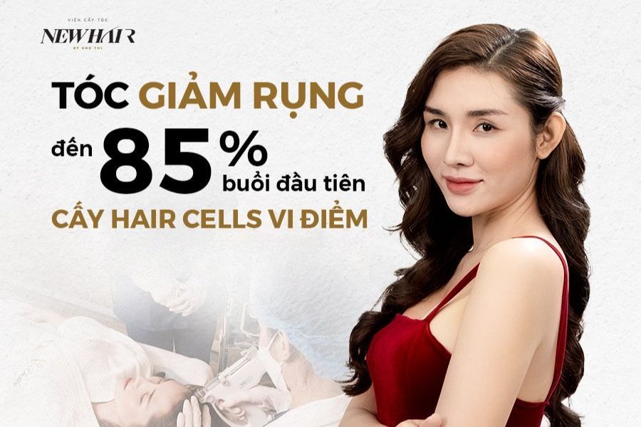 Cấy Hair Cells vi điểm cách trị hói an toàn nhất