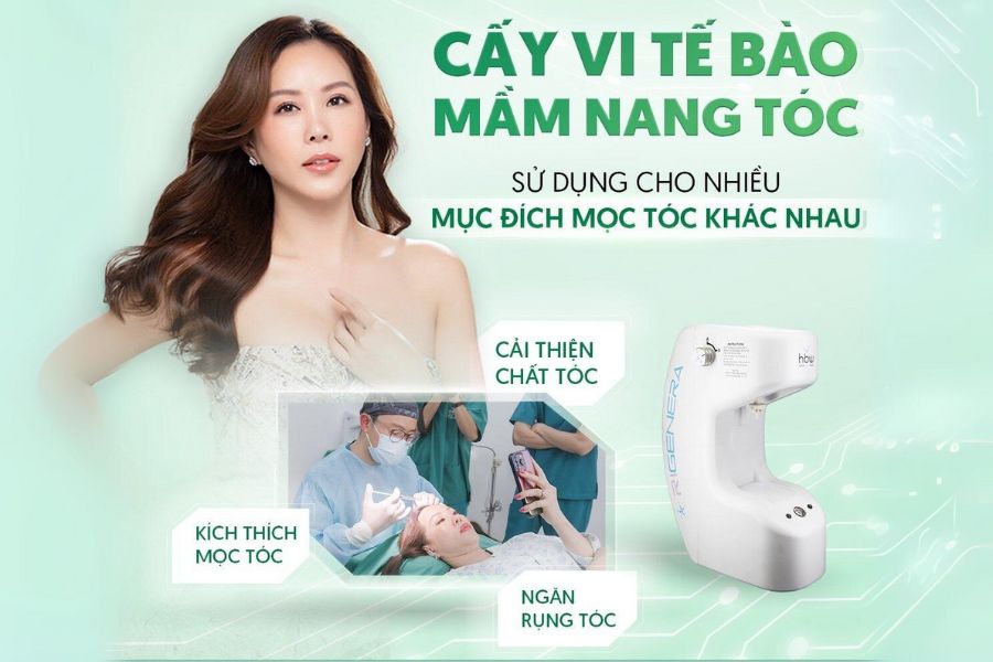 Cách trị hói đầu cấy vi tế bào mầm nang tóc có thể thực hiện trước hoặc sau cấy tóc tự thân để tăng hiệu quả trị hói