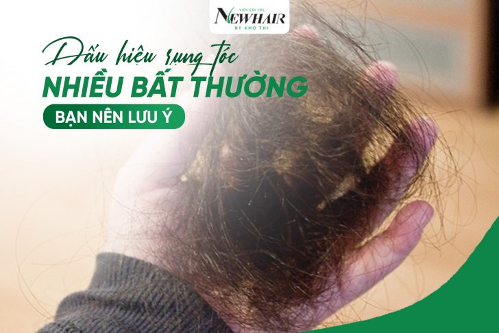 Dau hieu rung toc nhieu bat thuong ban nen luu y