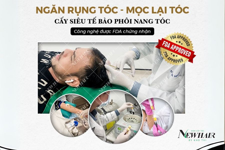 Trị hói đầu