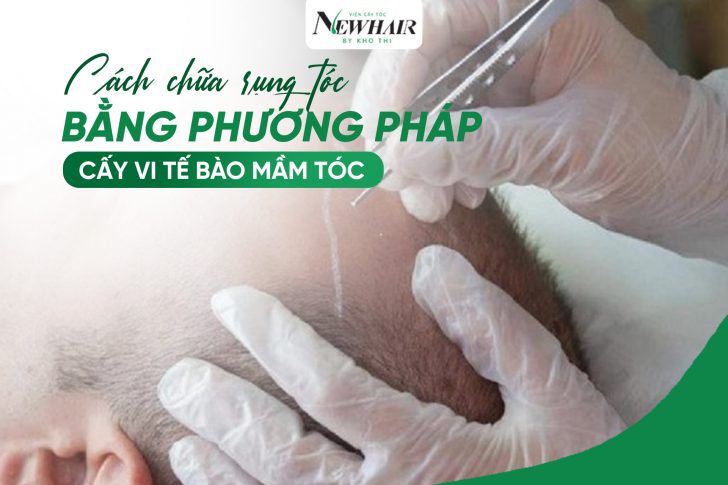 Cách chữa rụng tóc