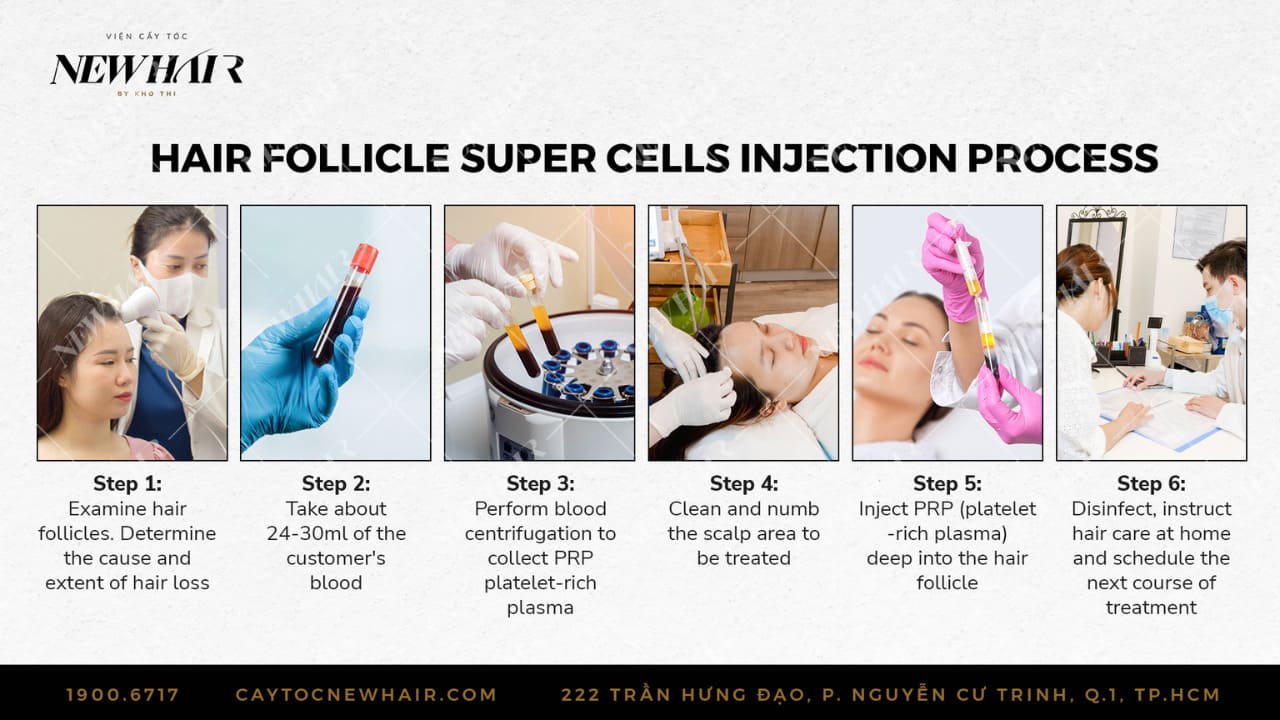 hair follicle super cells injection